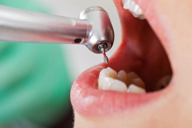 Best Emergency Dental Care for Abscessed Tooth in Hidalgo, TX
